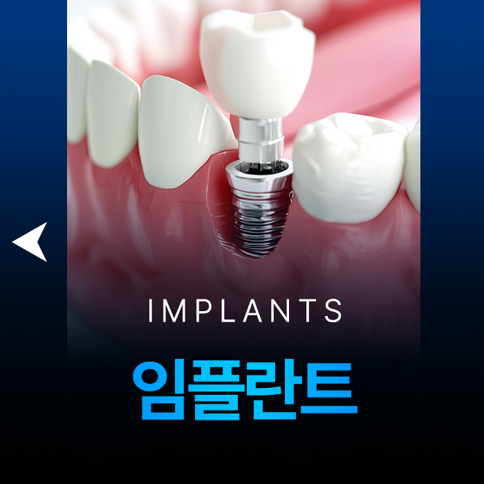덕천임플란트