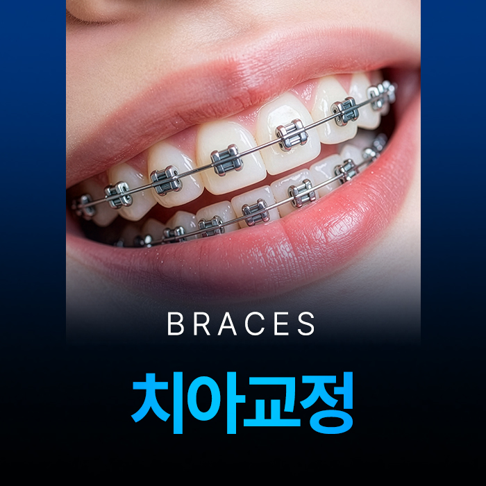 덕천치아교정