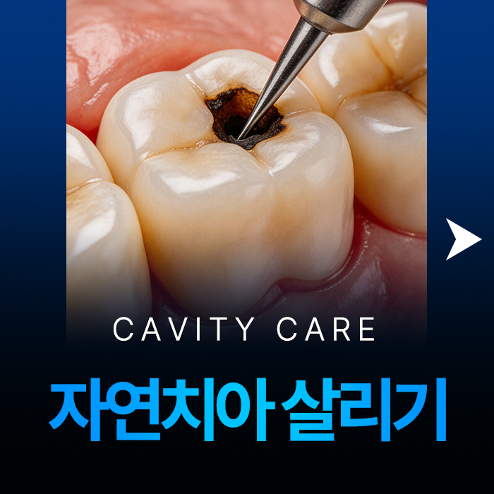 덕천자연치아살리기